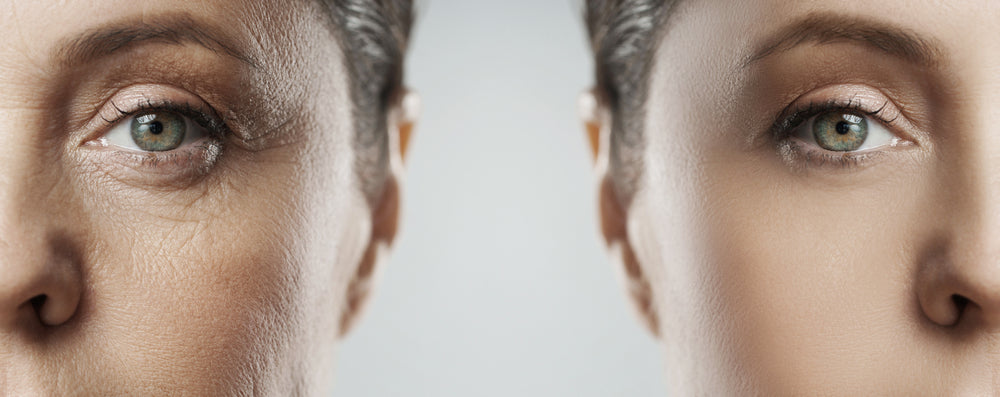 Informasjon om IV-behandling: Anti Age, Immuneboost + Detox på Storebotn Helse & Velvære