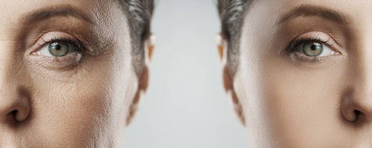 Informasjon om IV-behandling: Anti Age, Immuneboost + Detox på Storebotn Helse & Velvære